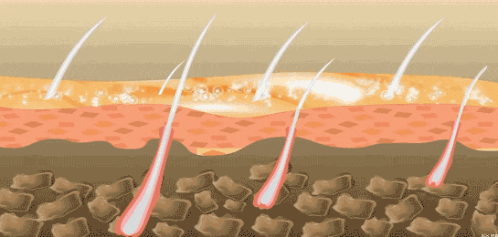 1.gif