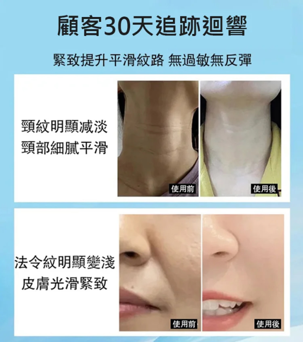 全方位提拉緊致導入儀