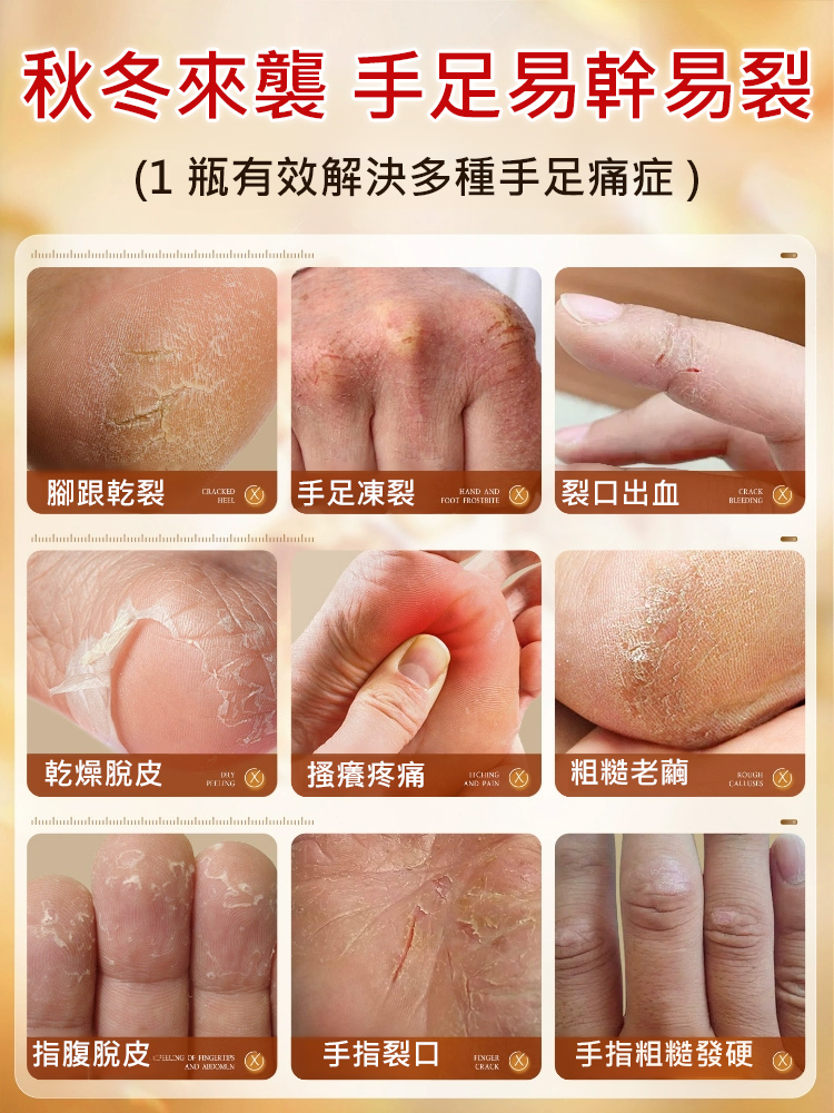 【3天癒合乾裂】手足皸裂膏