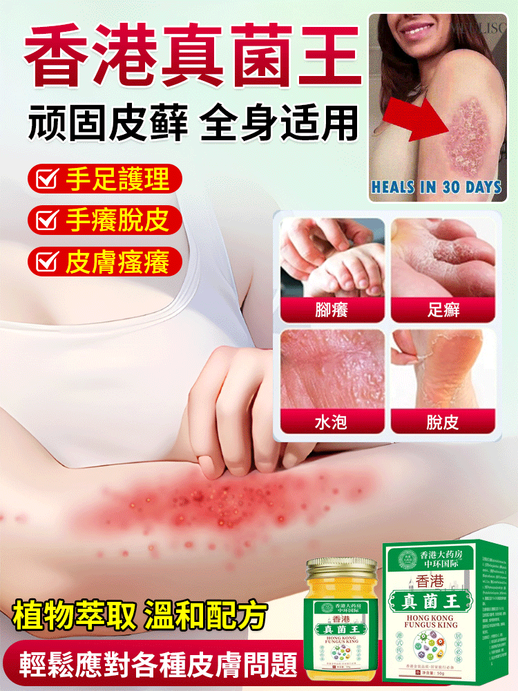 香港真菌王