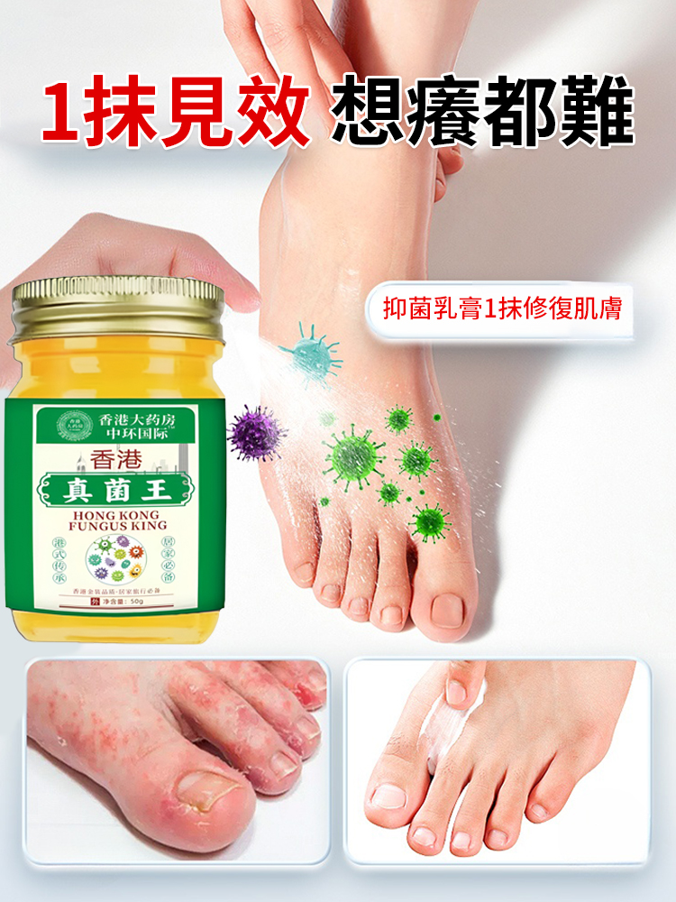 香港真菌王
