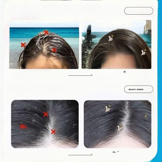 แชมพูคุมมันกำจัดรังแค 