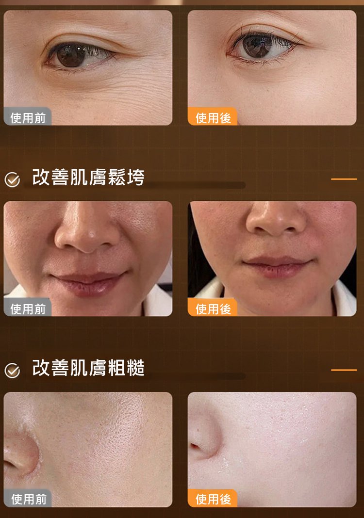 翻译件-HFH-胶原蛋白淡纹抗皱珍珠填充霜-1348576-系统_08.jpg