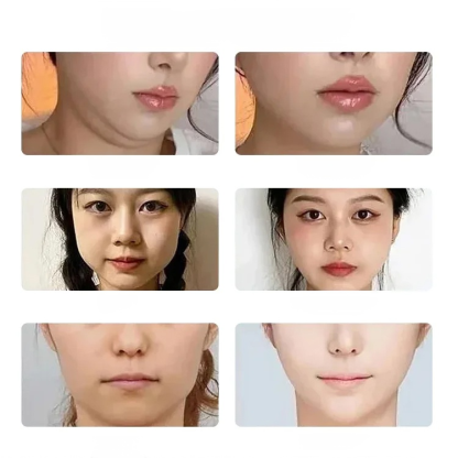 🌙✨ หน้าสวยไม่ต้องกลัว! ✨🌙 😴💤 สวมใส่สบาย ช่วยป้องกันริ้วรอย! 💖😌 🌟💪 ช่วยยกกระชับผิวหน้าให้ดูเด็ก! 🌼🌈 💖🌜 ฝันดี ตื่นมาหน้าสดใส! 🌞🌸