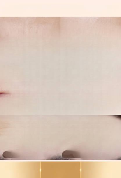 💎✨ ​​"สวยล้ำไร้ร่องรอย! 3D Face Lift Tape"​​📌✨ แปะปุ๊บ-หน้าเรียวปัง! กระชับผิวไร้ร่องรอยแบบธรรมชาติ 🌞💄 ใช้ได้ทั้งวัน ทั้งใ#ความลับหน้าเด็ก