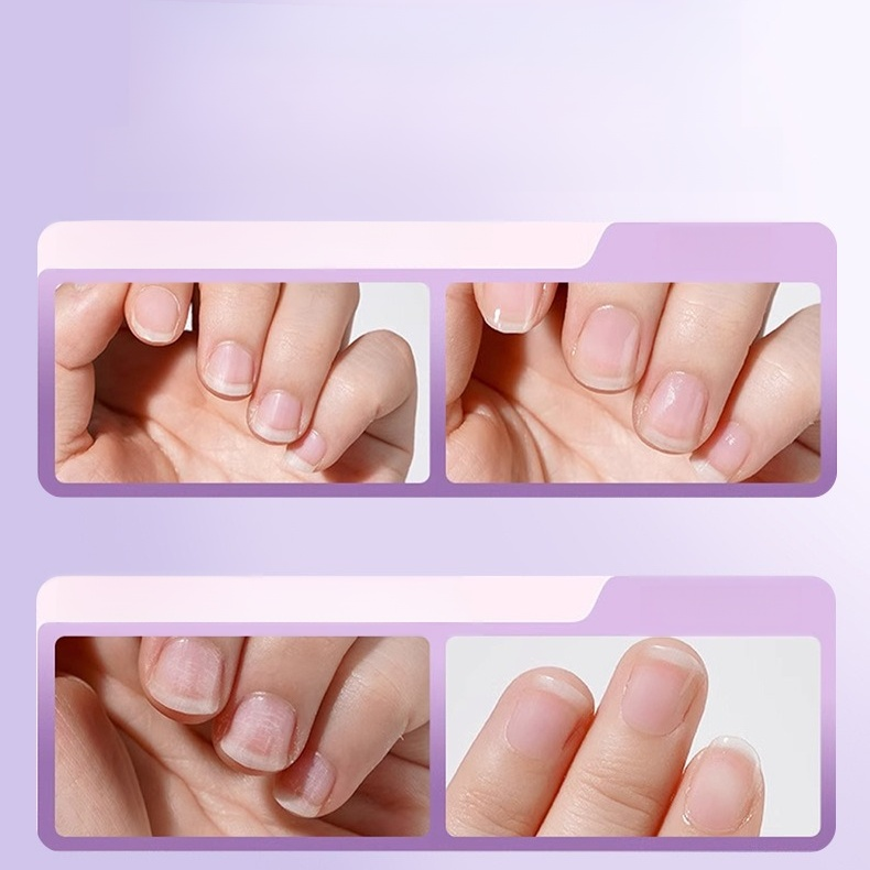 [เล็บเงาวับใน 1 วินาที] เล็บพังแค่ไหนก็กู้ได้! 💅✨ เปลี่ยนเล็บขุ่นให้ใสปิ๊ง! ปาดเดียวจบ. ✅เล็บเงาสวยเหมือนทำร้าน.