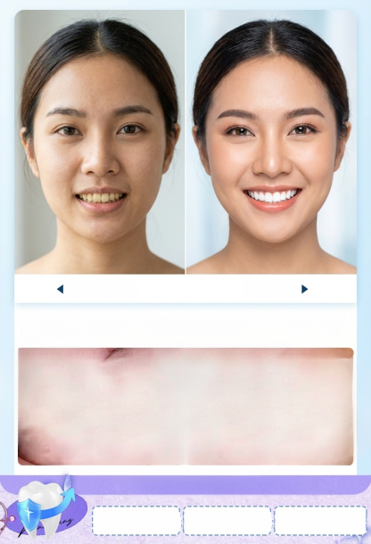 ✨ 【ฟันขาวใน 7 วัน】แผ่นฟอกฟันขาวสูตรเข้มข้น – ยิ้มสวยมั่นใจ ฟันขาวขึ้นอย่างเป็นธรรมชาติ ไม่เสียวฟัน! 🦷✨🔥 โปรโมชั่นพิเศษสำหรับวันนี้!