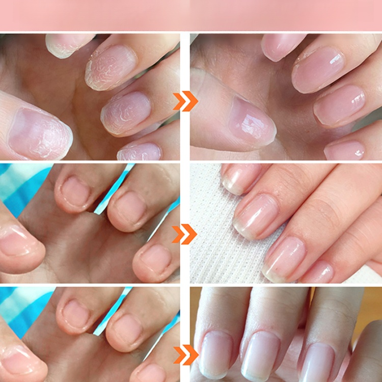 [เล็บเงาวับใน 1 วินาที] เล็บพังแค่ไหนก็กู้ได้! 💅✨ เปลี่ยนเล็บขุ่นให้ใสปิ๊ง! ปาดเดียวจบ. ✅เล็บเงาสวยเหมือนทำร้าน.