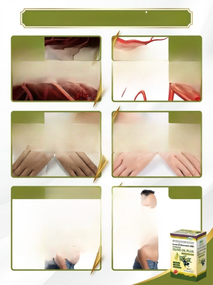 【บำรุงหลอดเลือดและหัวใจ】แคปซูลน้ำมันมะกอก ทานง่าย ไม่เลี่ยน ประโยชน์ครบ