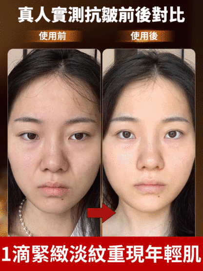 【抗皺逆齡王】膠原蛋白抗皺精華液