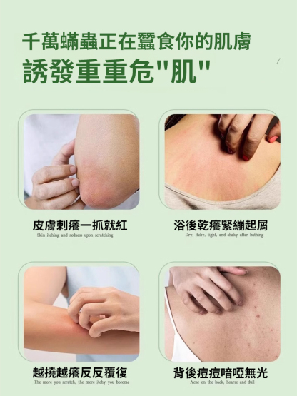 除蟎淨痘艾草精油皂