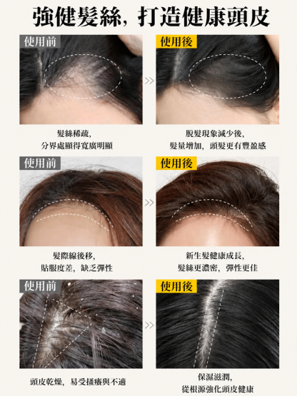 SL-免沖洗精油護紅光髮梳