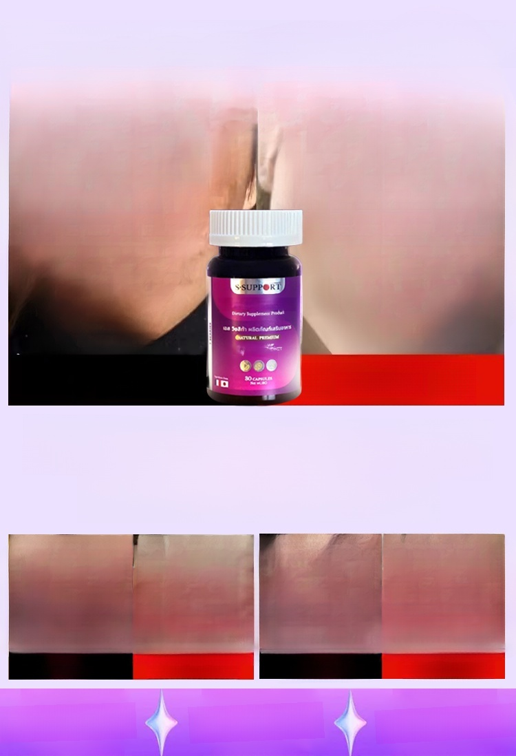 【จุดด่างดำหายไป】แคปซูลวิตามินรวมสำหรับผู้หญิง 5 ส่วนผสมมหัศจรรย์ ช่วยให้ผิวขาวใส แข็งแรง จากภายในสู่ภายนอก