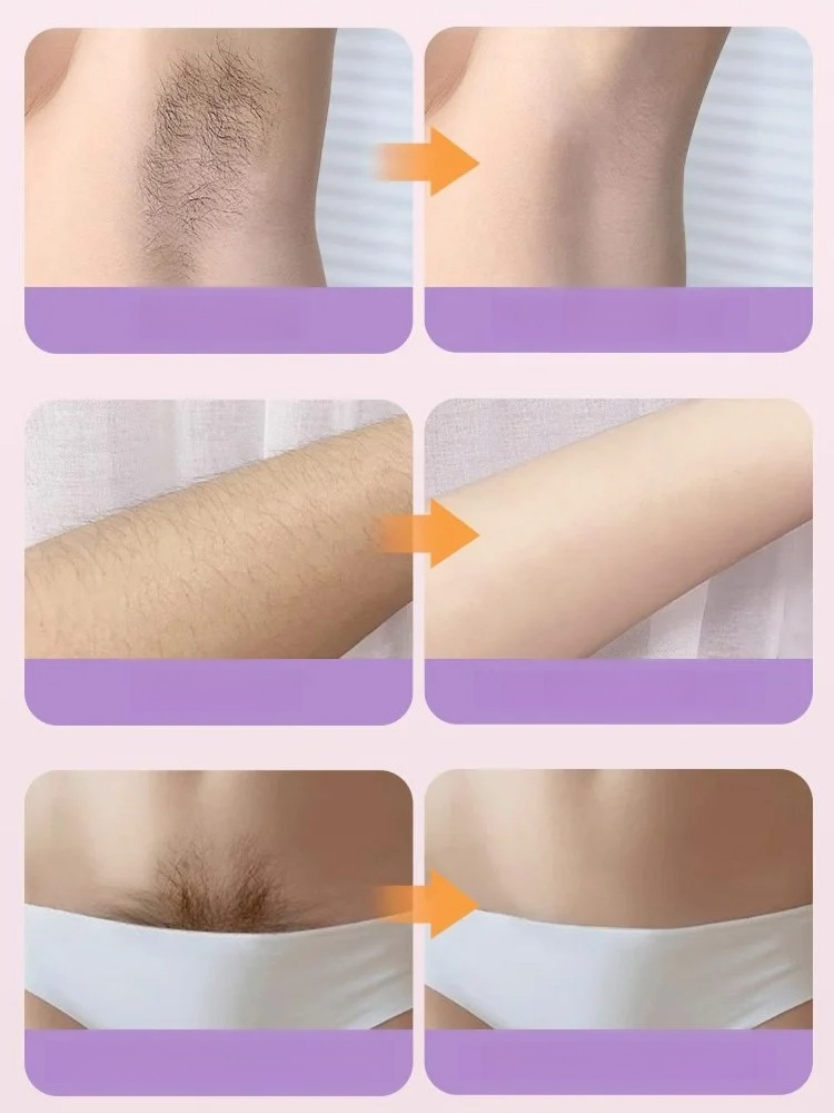 เครื่องโกนหนวดสองหัวที่ขายดีที่สุด สาวไทยต้องมีรับซัมเมอร์! เครื่องกำจัดขนหัวคู่ อ่อนโยนไม่ทิ้งจุดดำ ใส่สายเดี่ยวได้อย่างมั่นใจ