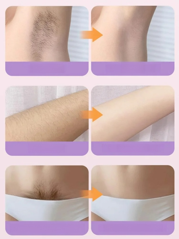 เครื่องโกนหนวดสองหัวที่ขายดีที่สุด สาวไทยต้องมีรับซัมเมอร์! เครื่องกำจัดขนหัวคู่ อ่อนโยนไม่ทิ้งจุดดำ ใส่สายเดี่ยวได้อย่างมั่นใจ