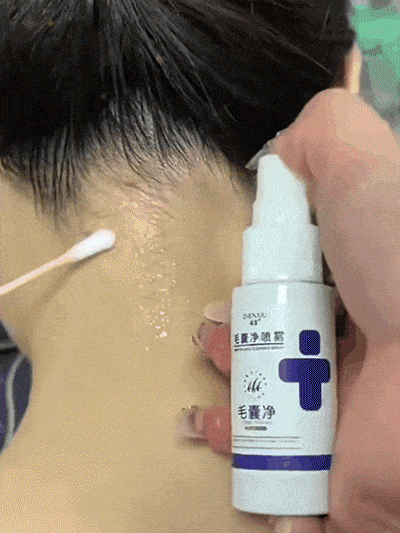 Deep Cleansing Follicle Purifying Spray