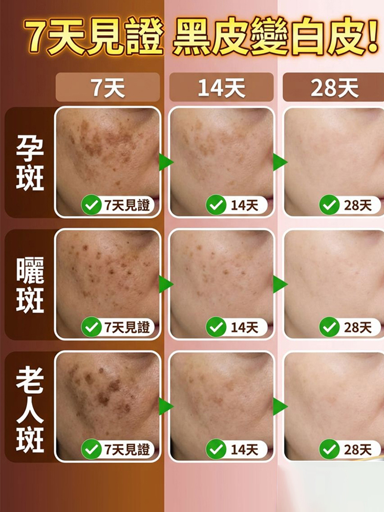 氨甲環酸美白祛斑抗皺霜
