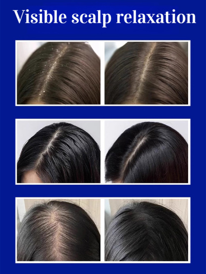 Deep Cleansing Follicle Purifying Spray