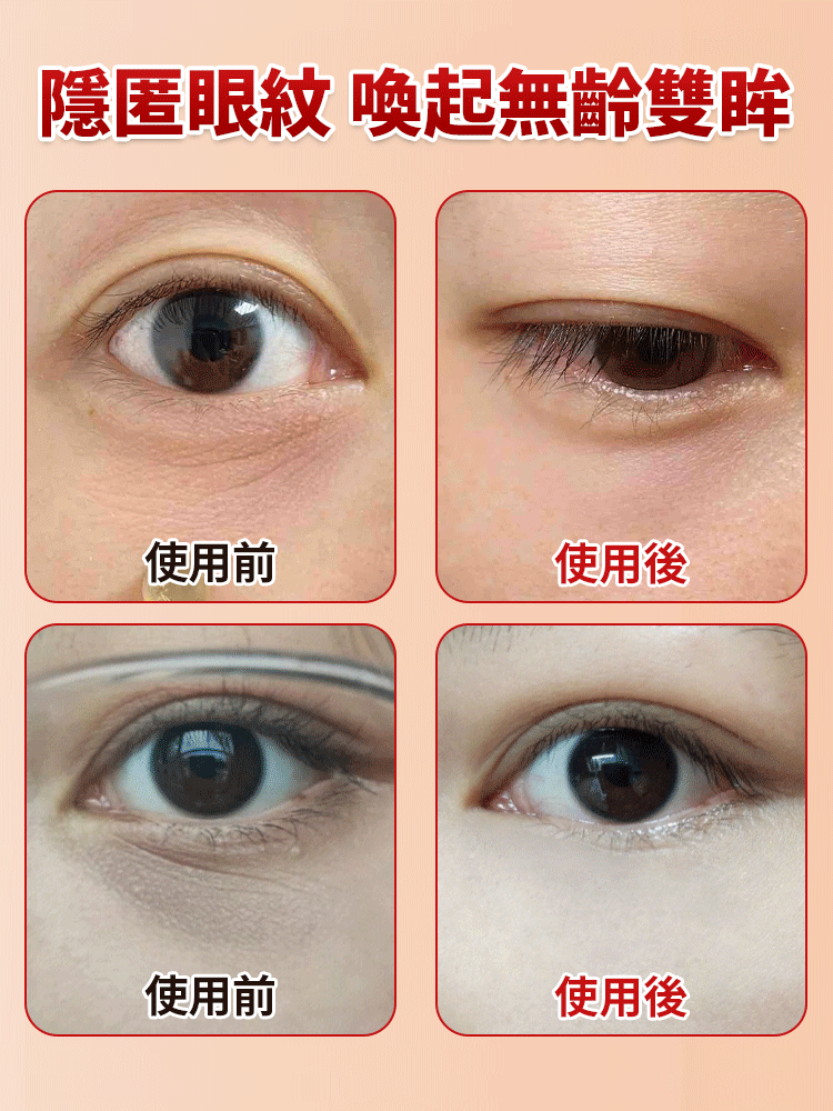 【7天淡紋】眼部抗皺植萃精華油