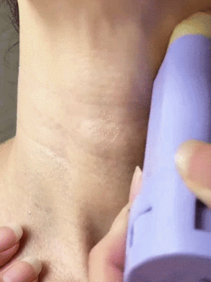 [Bionic Snake Oil Complex Formula] Wrinkle Removal Stick【Suitable for use on the neck, face, and entire body—you’ll see visible results in just 7 days!】
