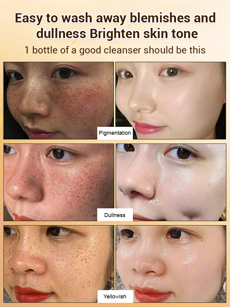[Specially for stubborn spots] Upgraded anti-freckle essence oil
