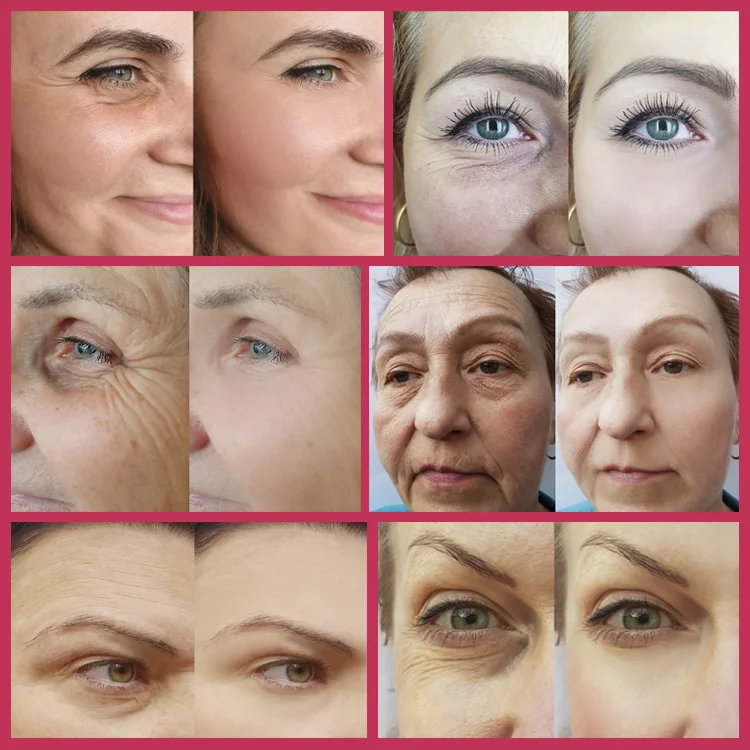 Antioxidant Niacinamide Berry Flavored Drink