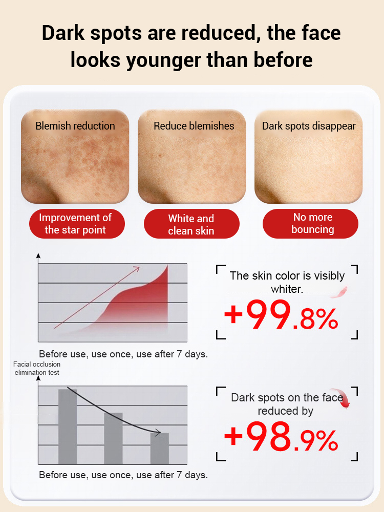 [Specially for stubborn spots] Upgraded anti-freckle essence oil