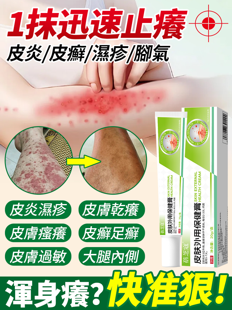 【想癢都難】止癢抑菌皮膚修復膏