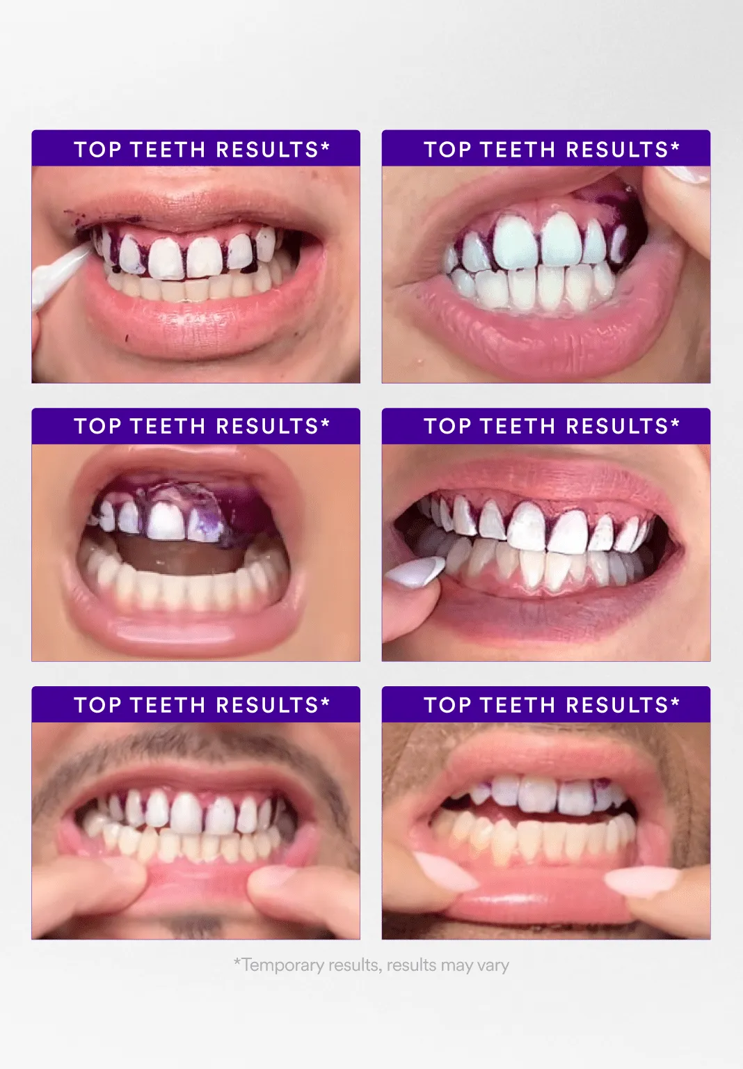 5D Whitening Strips