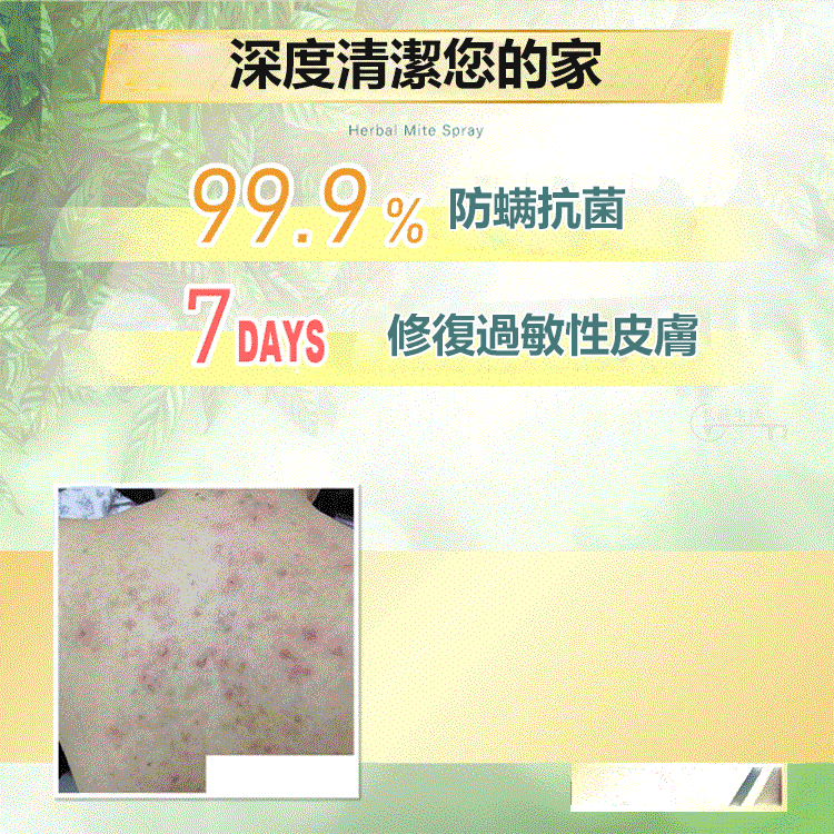 【純天然青花椒精華】強效防蟎除蟎噴劑