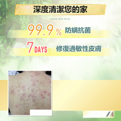 【純天然青花椒精華】強效防蟎除蟎噴劑