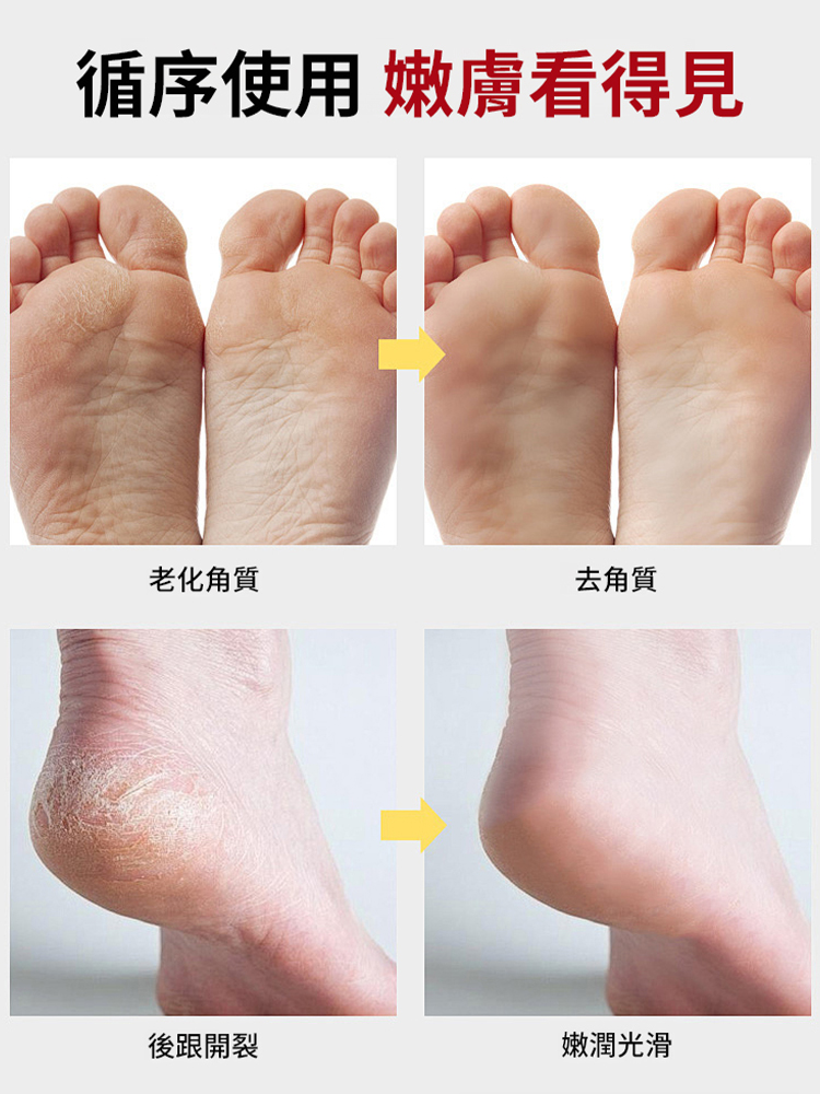 雙面修腳磨腳神器