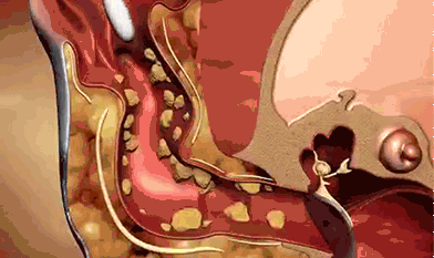 1_04.gif