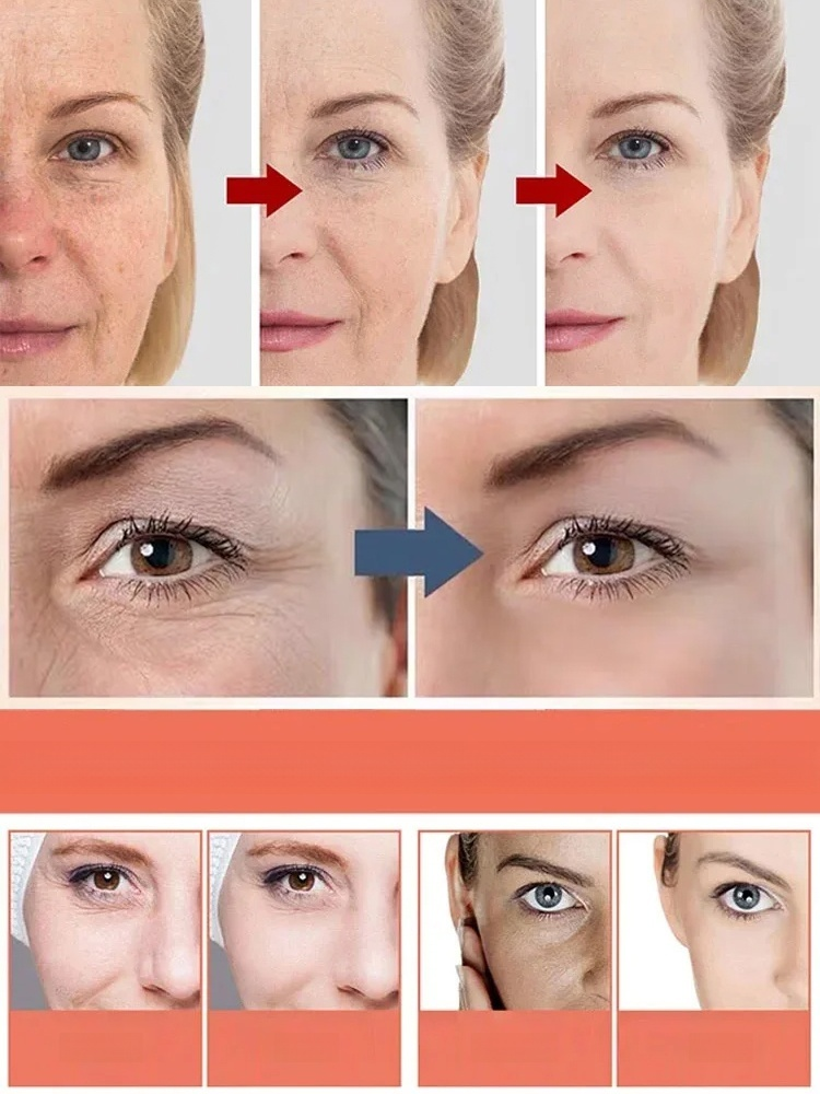 ✨🥰[Anti-Wrinkle and Yellowing Reduction] Professional Facial Anti-Wrinkle Cream