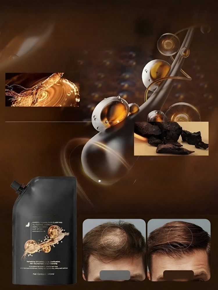 【ขจัดผมร่วง สร้างเส้นผมใหม่! 】แชมพูสมุนไพรเห็ดหลินจือดำและโชวู