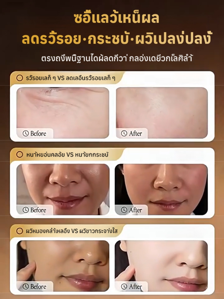 ครีมโสมพีโอนีบำรุงผิวต่อต้านริ้วรอย