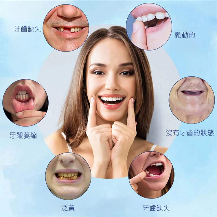 牙齒美容假牙修飾套裝