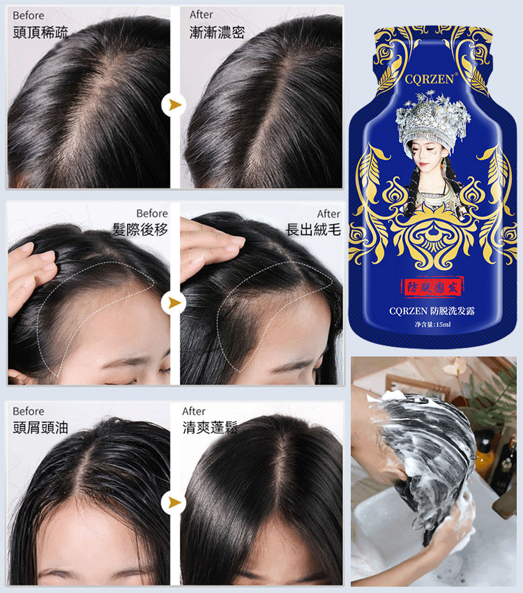 防脫育發洗髮露