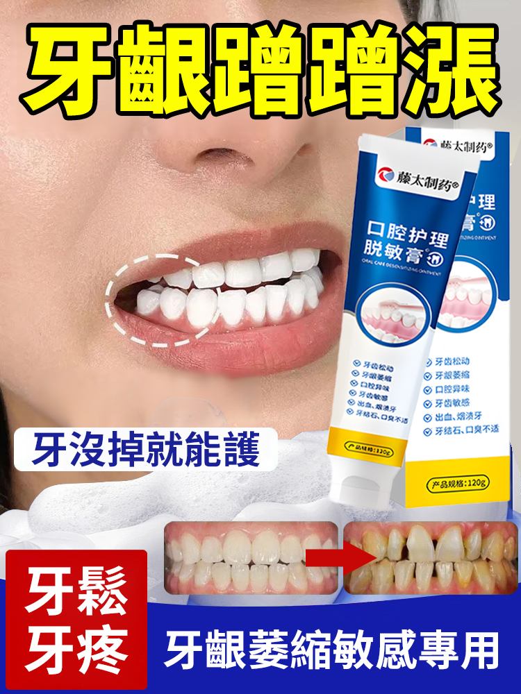 口腔護理脫敏膏