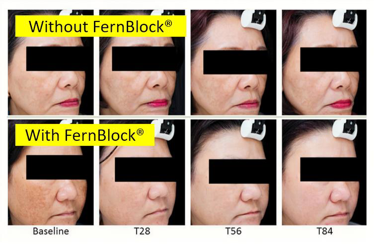 ENHANCED Fern block works