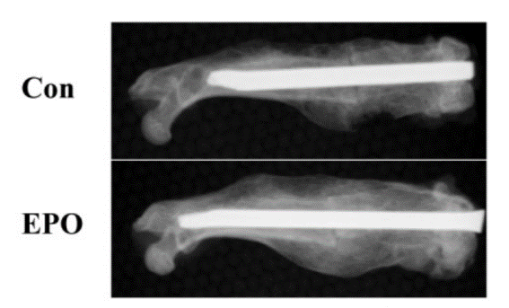 bone scans