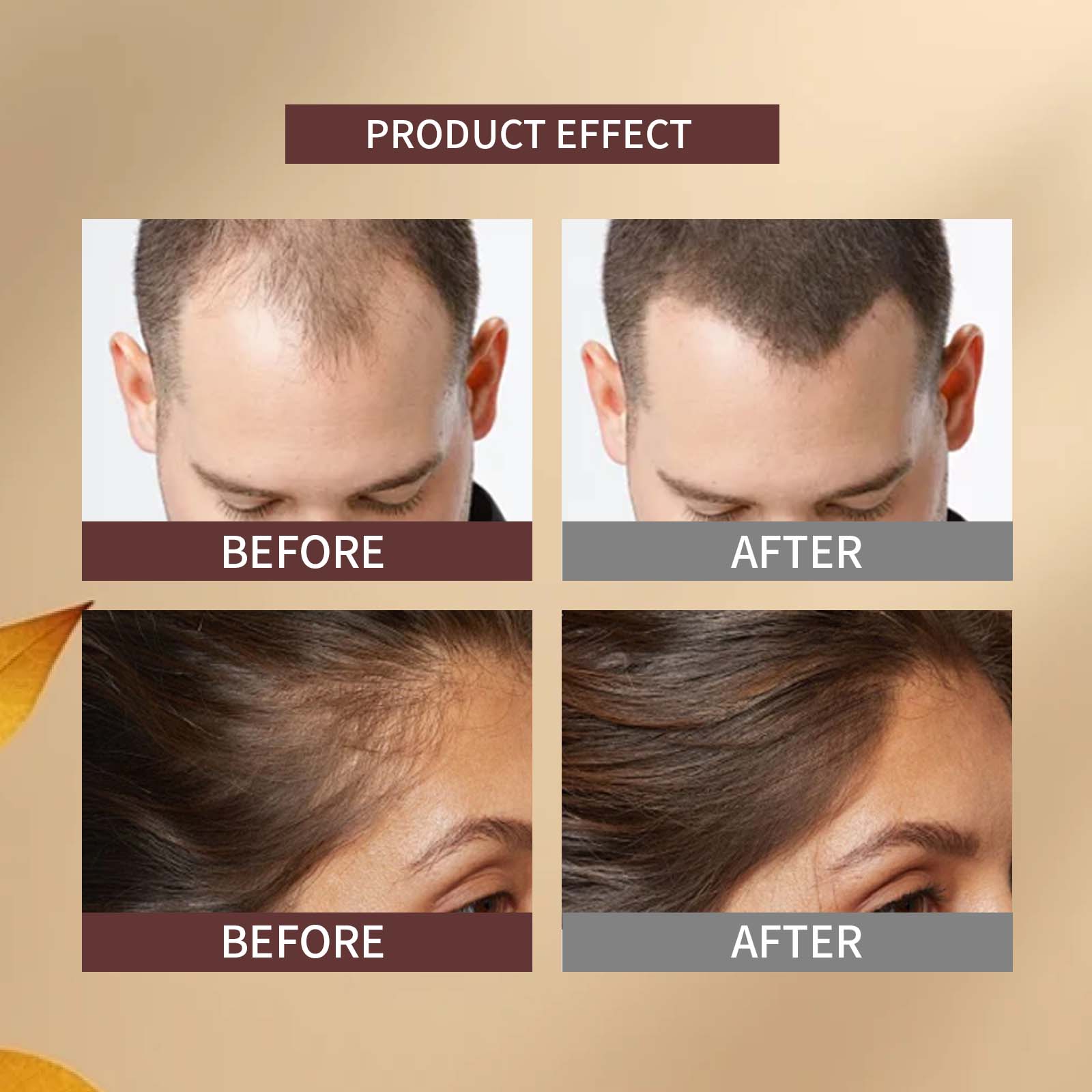 Adult anti hair loss shampoo