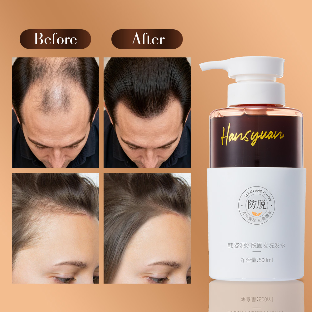 Anti hair loss and stabilization shampoo