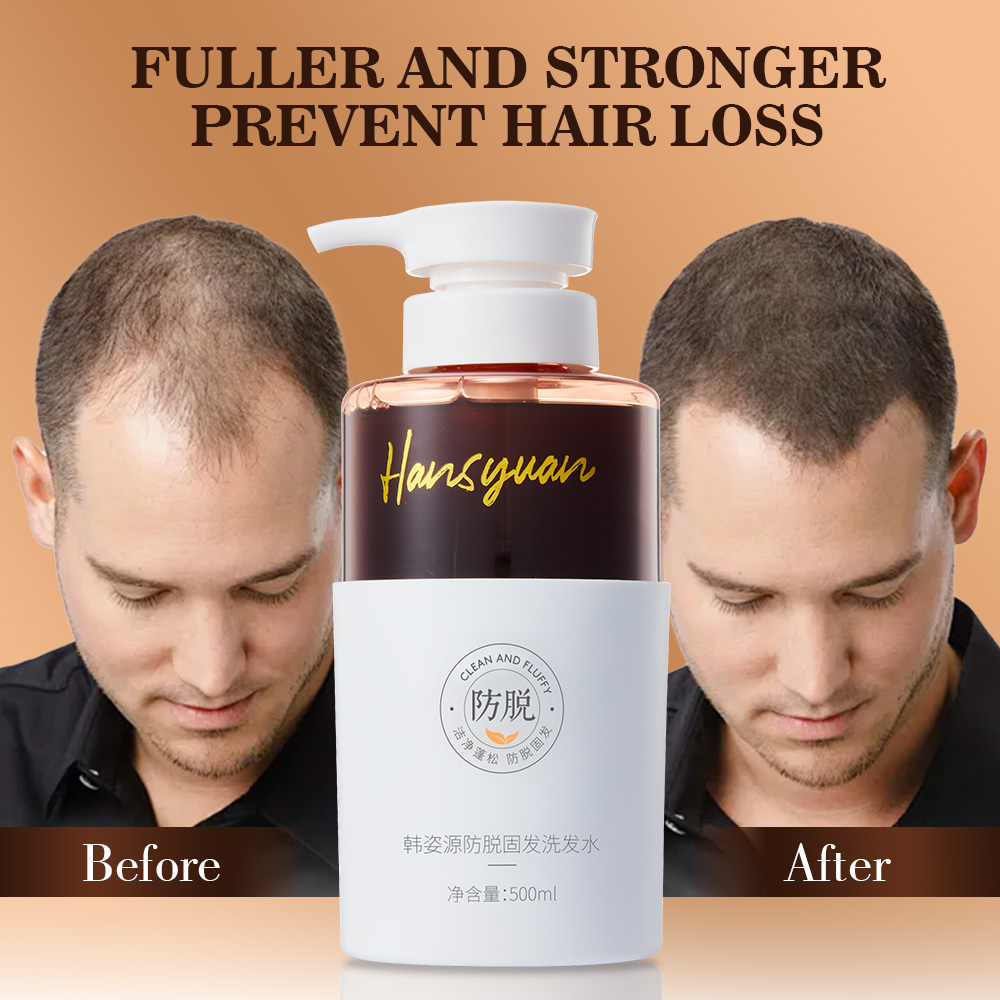 Anti hair loss and stabilization shampoo