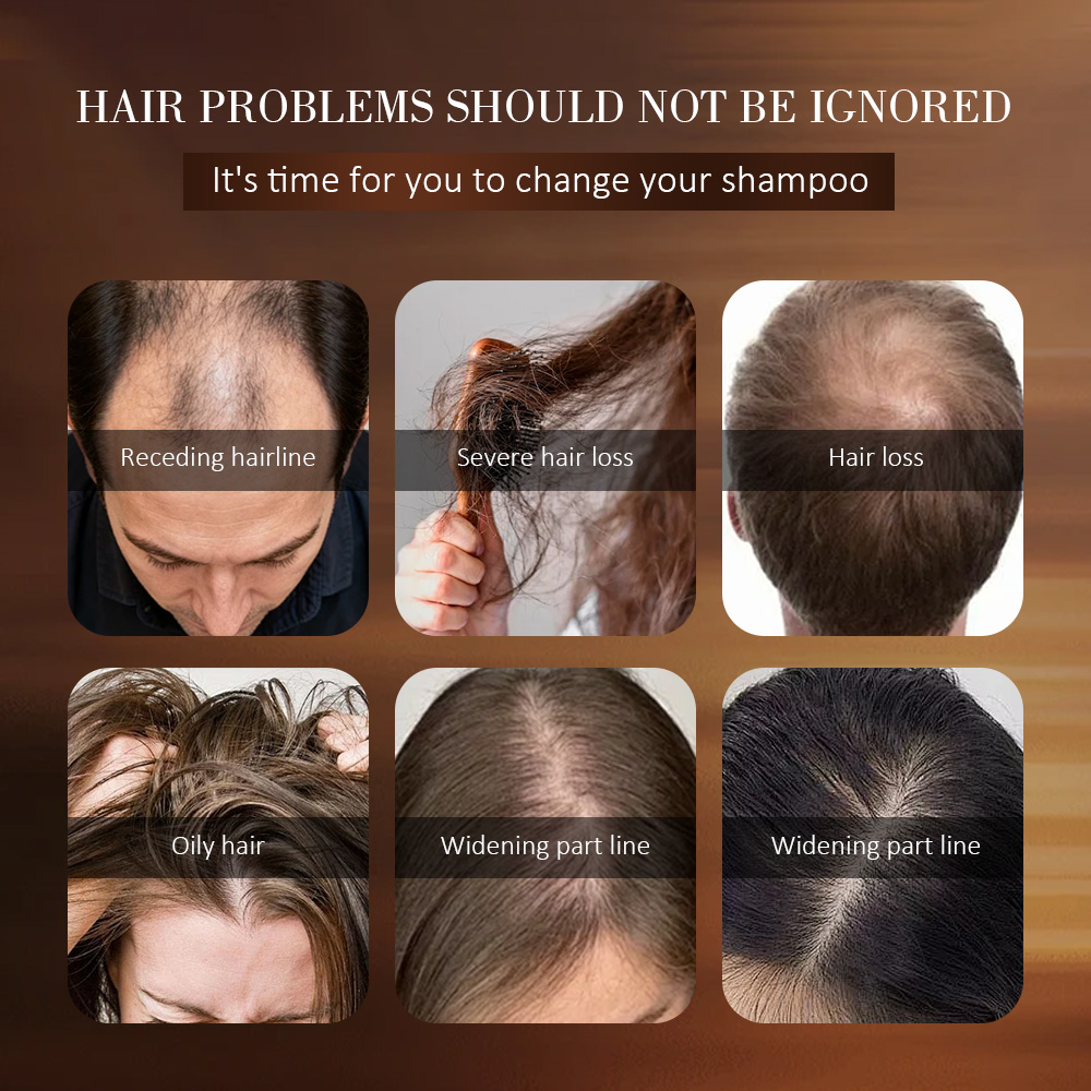 Anti hair loss and stabilization shampoo