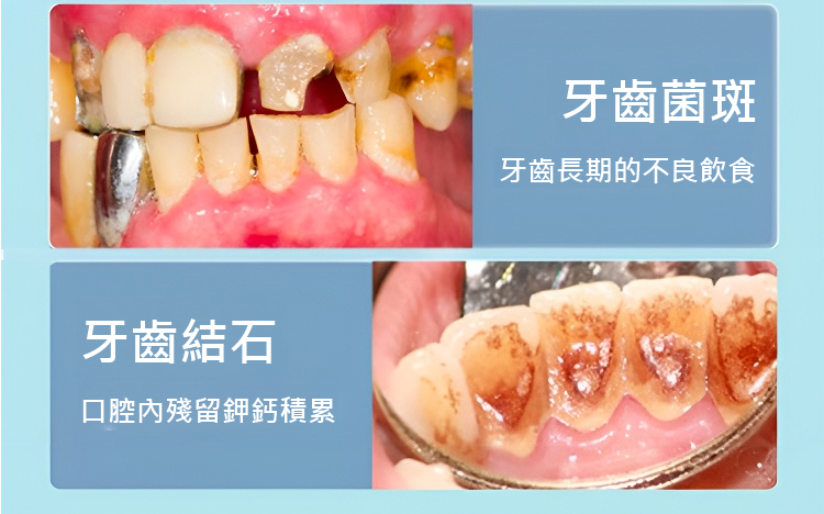 翻译件-JC-真超声波洁牙器-1143252_05.jpg