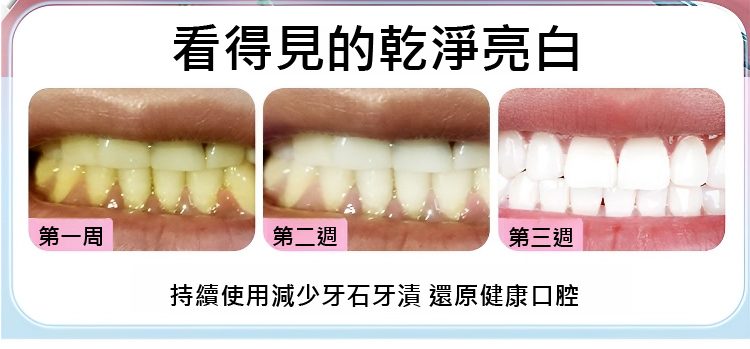 翻译件-JC-真超声波洁牙器-1143252_12.jpg