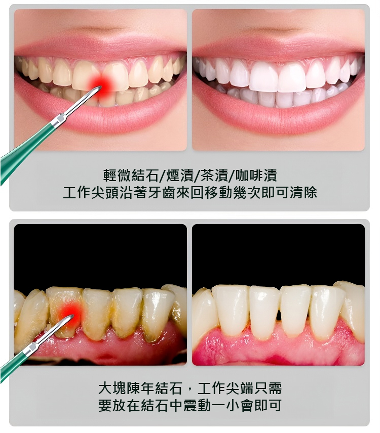 翻译件-JC-真超声波洁牙器-1143252_22.jpg