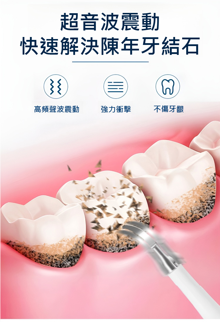 翻译件-JC-真超声波洁牙器-1143252_19.jpg