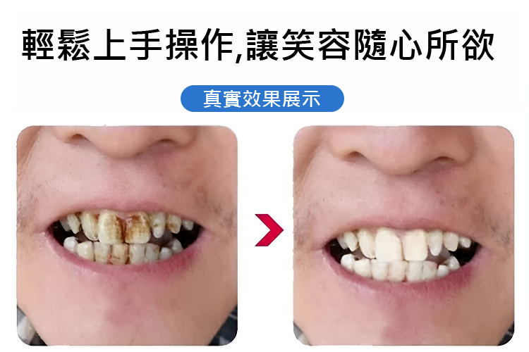 翻译件-JC-真超声波洁牙器-1143252_29.jpg